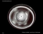 proteus mirabilis on blood agar